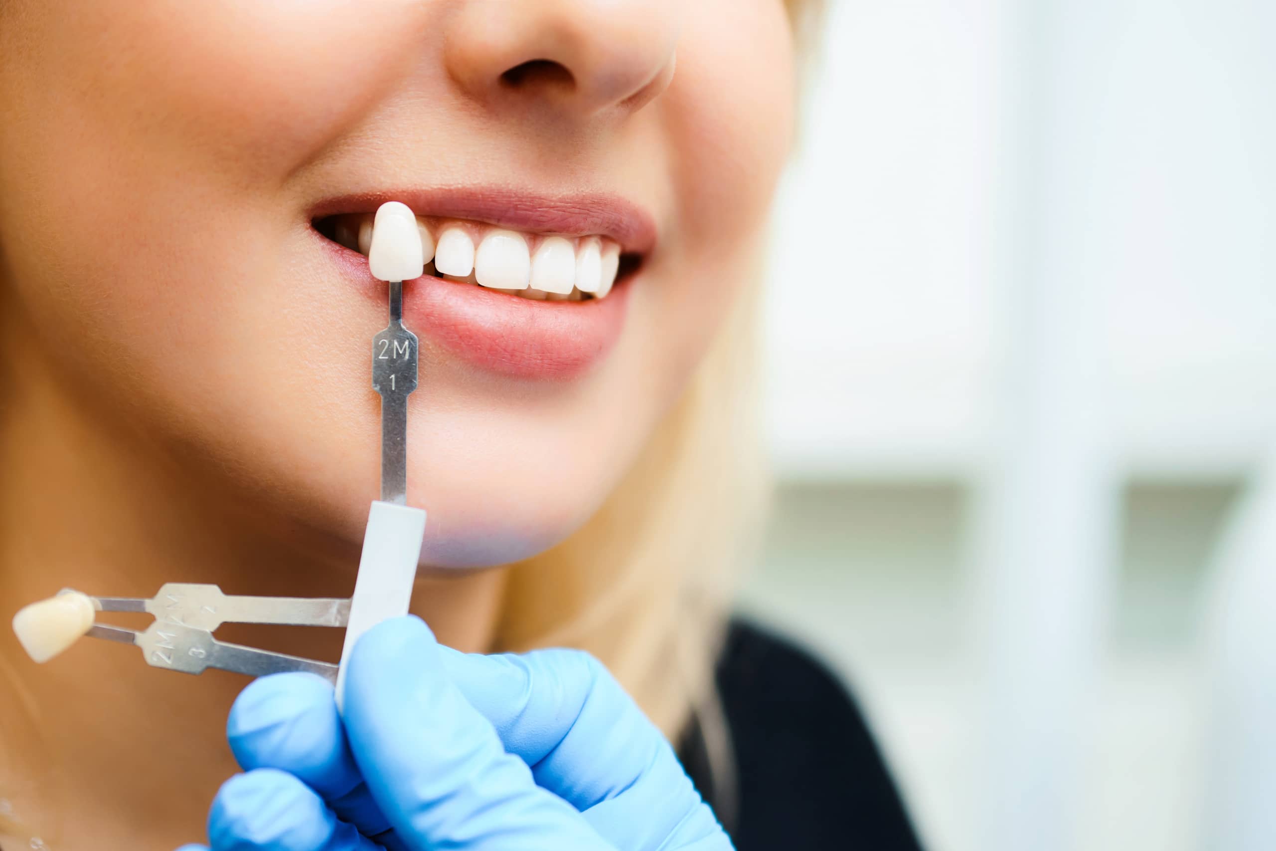 Teeth whitening in Letchworth