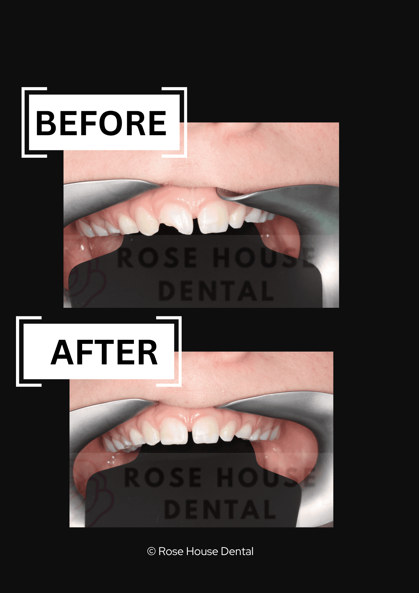 Dental emergency experts with children. North Hertfordshire urgent dental treatment for children