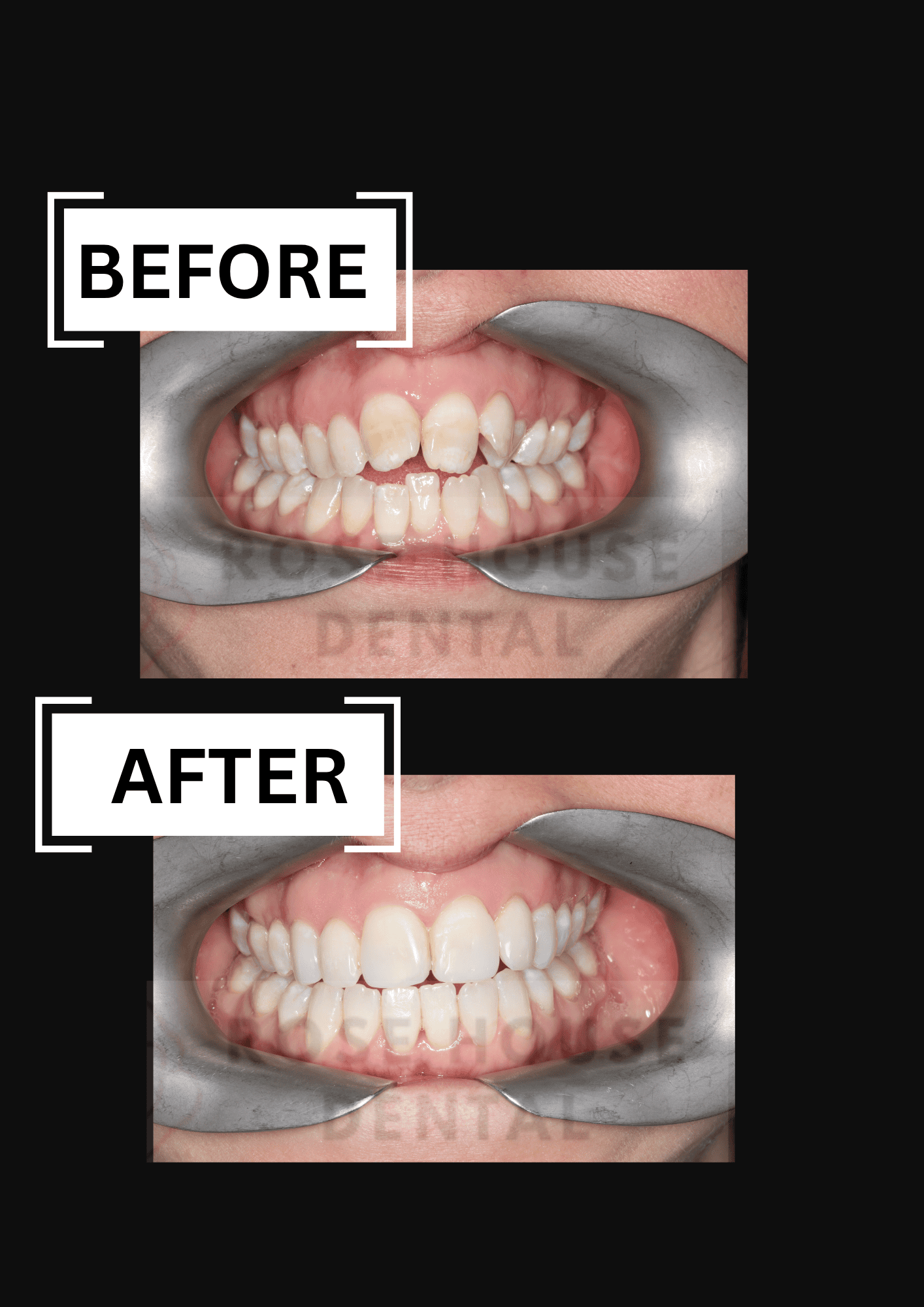 Dr Ashish Vora treatment for ortho treatment at Rose House Dental
