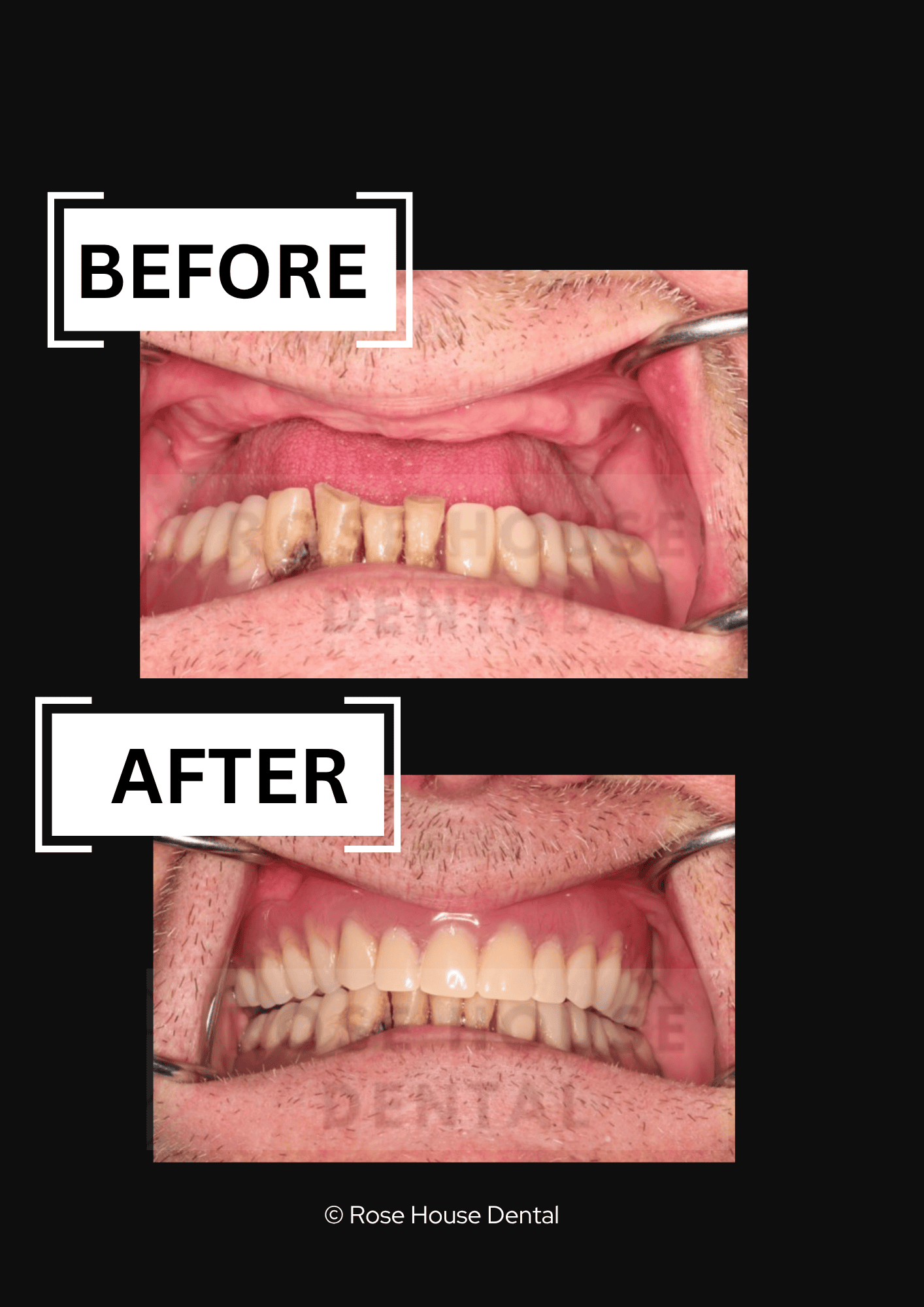 Dr Kiran Mistry. Denture replacement and new dentures.