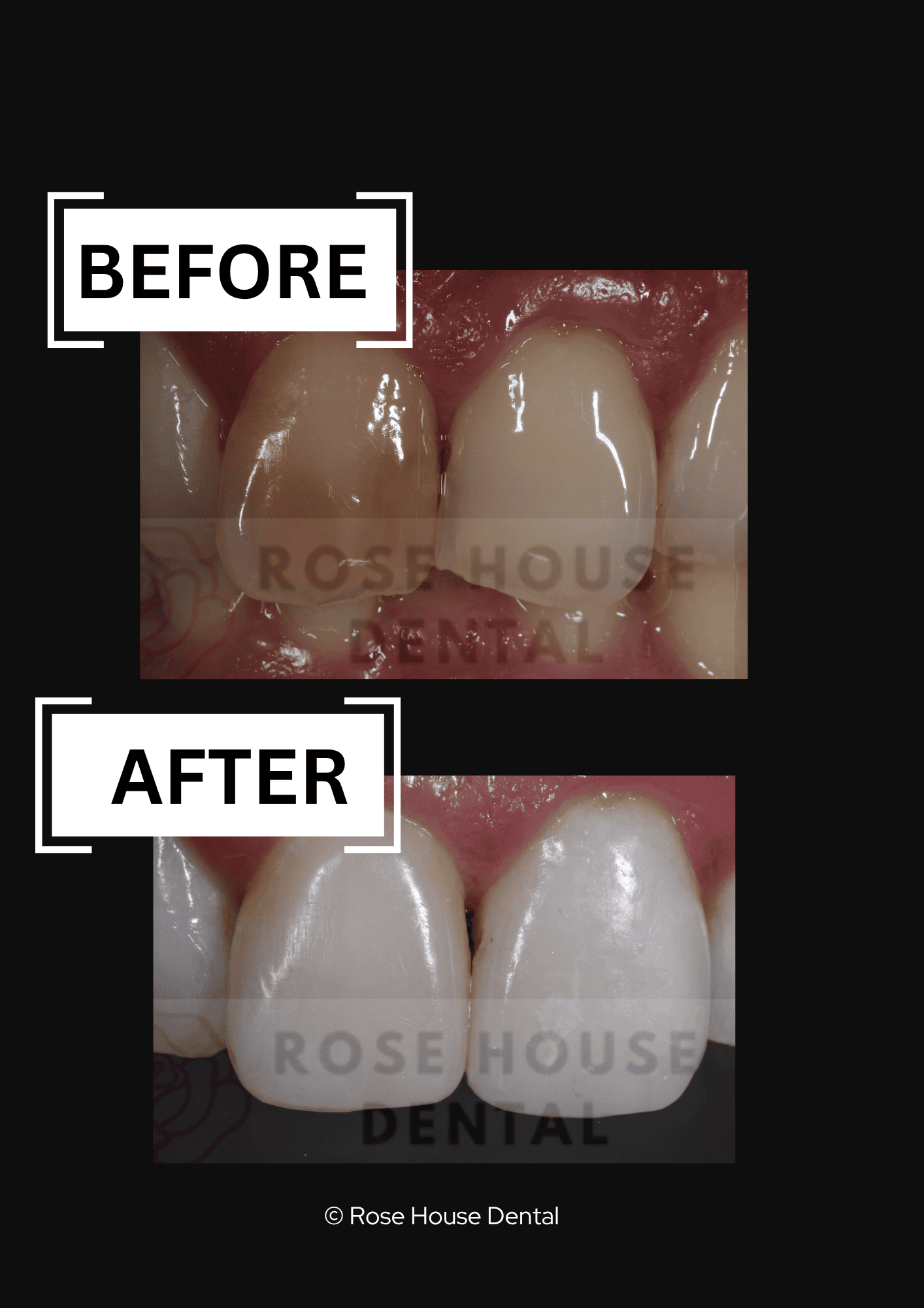 Dr Krushan Lad cosmetic treatment at Rose House Dental